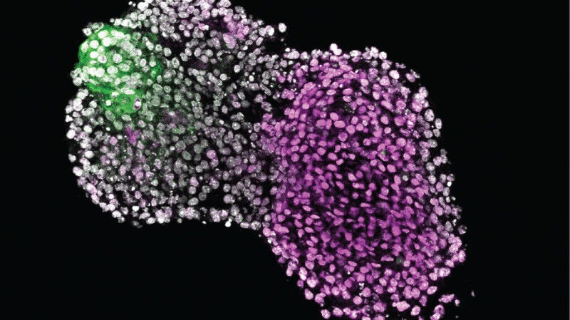 Fluorescence imaging of a budoid. Magenta: forming cartilage. Green: AER cells.