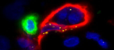 Une enzyme pour d�sarmer les tumeurs