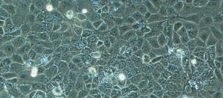 Une plateforme test pour les futurs traitements anticancer