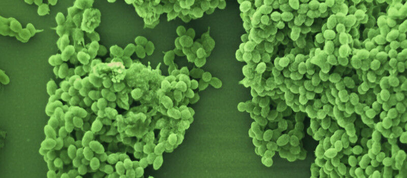 Bakterien zum Schweigen zu bringen kann Herzinfektionen verschlimmern