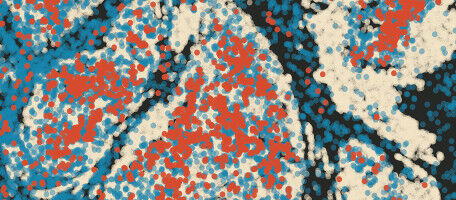 Immune 'hijacking' predicts cancer evolution