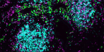 Local immune coordination in the lung reveals a new layer of defense