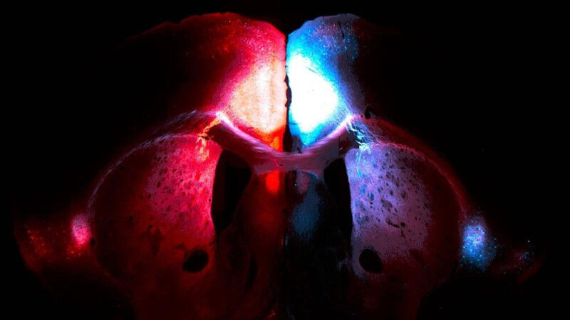 Image of a mouse brain, which Lucie Dixsaut, a doctoral student at the Neuroepig