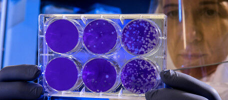 Renforcer notre immunit� face au risque de grippe aviaire