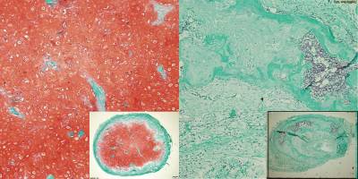 Basel researchers succeed in cultivating cartilage from stem cells