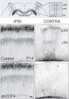Comment aider les neurones retardataires