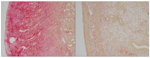 Découvrir la biologie d'une maladie pédiatrique défigurante