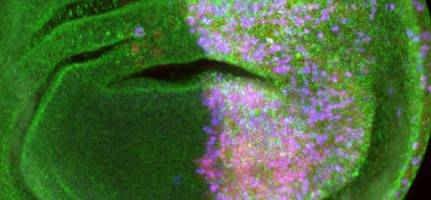 Die Strategie eines Tumors: Teile und herrsche