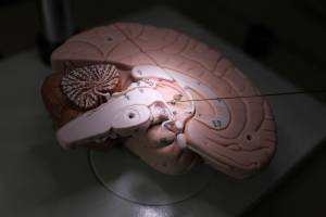 EPFL spin-off Aleva Neurotherapeutics raises 13 million dollars