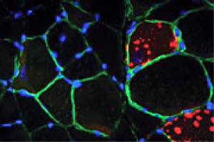 F�llt die Zellreinigung aus, entsteht Muskelschw�che