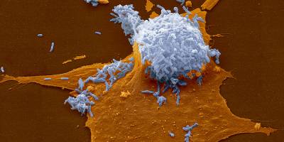 Gene Transfer Keeps Bacteria Fit