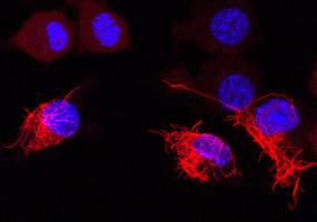 Immune cells on alert: Inflammasome activates emergency program