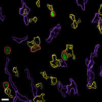 Josef Steiner Cancer Research Award 2025 promotes research on therapy resistance in cancer