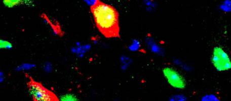 La dopamine, �l�ment cl� de l'addiction � l'h�ro�ne