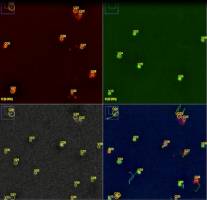 Le jetlag des cellules favoriserait l'apparition du diab�te