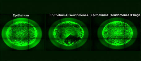 Mod�liser des poumons pour limiter les essais sur des souris