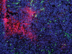 Nach einer anti-angiogenen Behandlung entstehen in Tumoren Regionen, die keine B