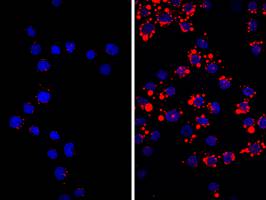 Neue Erkenntnisse zur Entstehung der Arterienverkalkung