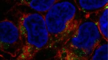 New immunotherapeutic agent for the treatment of Alzheimer's disease