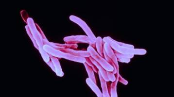 New perspectives for TB treatment.