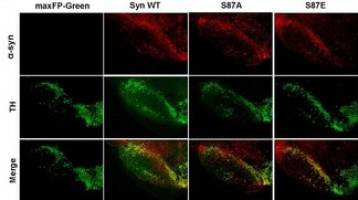 New therapeutic strategies for the treatment of Parkinson's disease