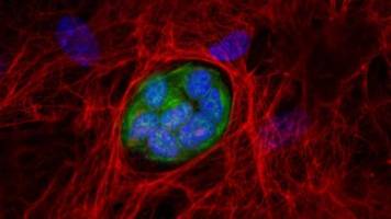 Nipping metastases in the bud