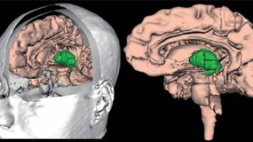 Thalamic control of cortical states