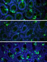 �bergewichtige haben zu wenig Zellen mit S�ttigungshormonen