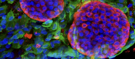 L UE mette in evidenza il progetto del pancreas bioartificiale dell UNIGE