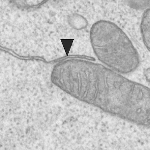 Beispiel einer Verbindung zwischen einem Mitochondrium und dem endoplasmatischen